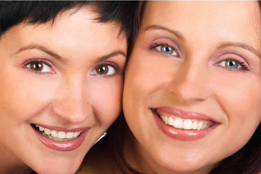 two women smile showing off their veneers